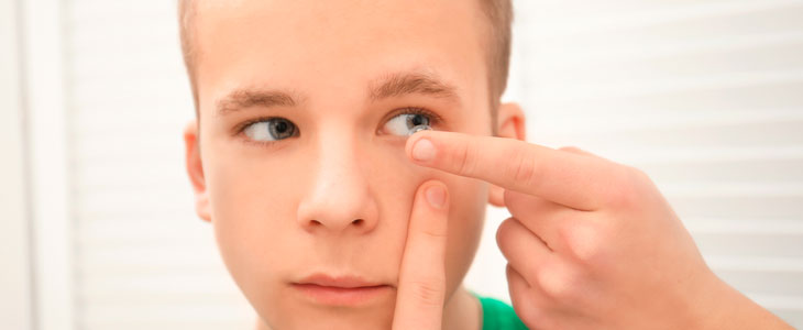 Контактные линзы и синдром сухого глаза у детей и подростков
